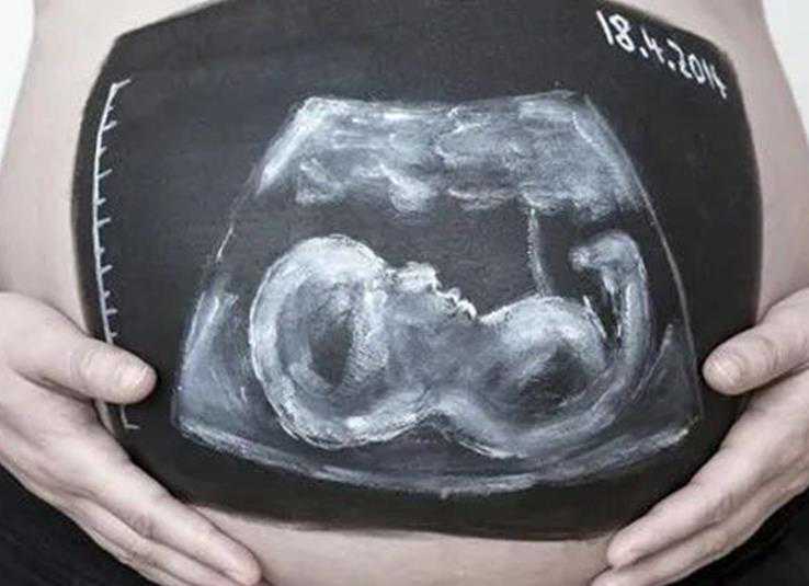 胎儿生长受限的